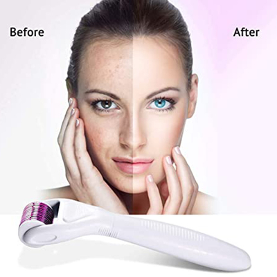 Konjac Derma Needle Roller For Acne Scars OEM Wrinkle Remover